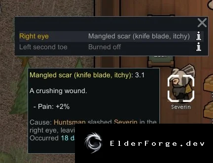 RimWorld: Причины травм и время их получения – постоянный вывод в Health