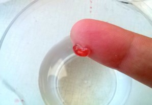 Step 5